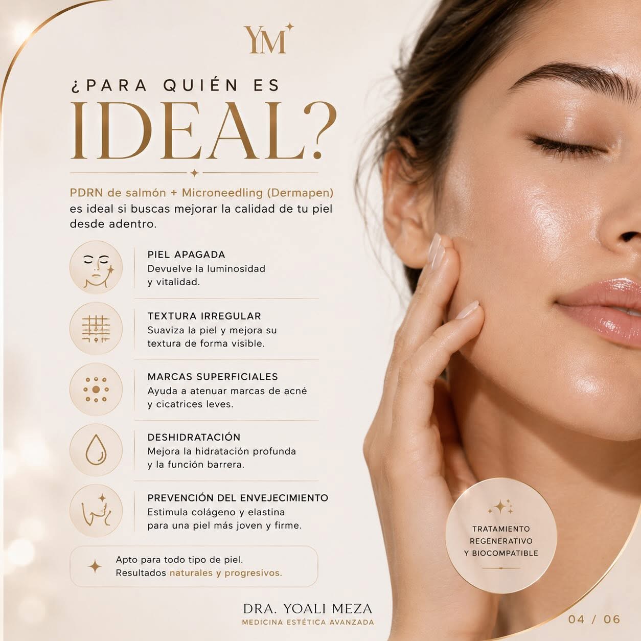 Indicaciones estéticas de PDRN y microneedling